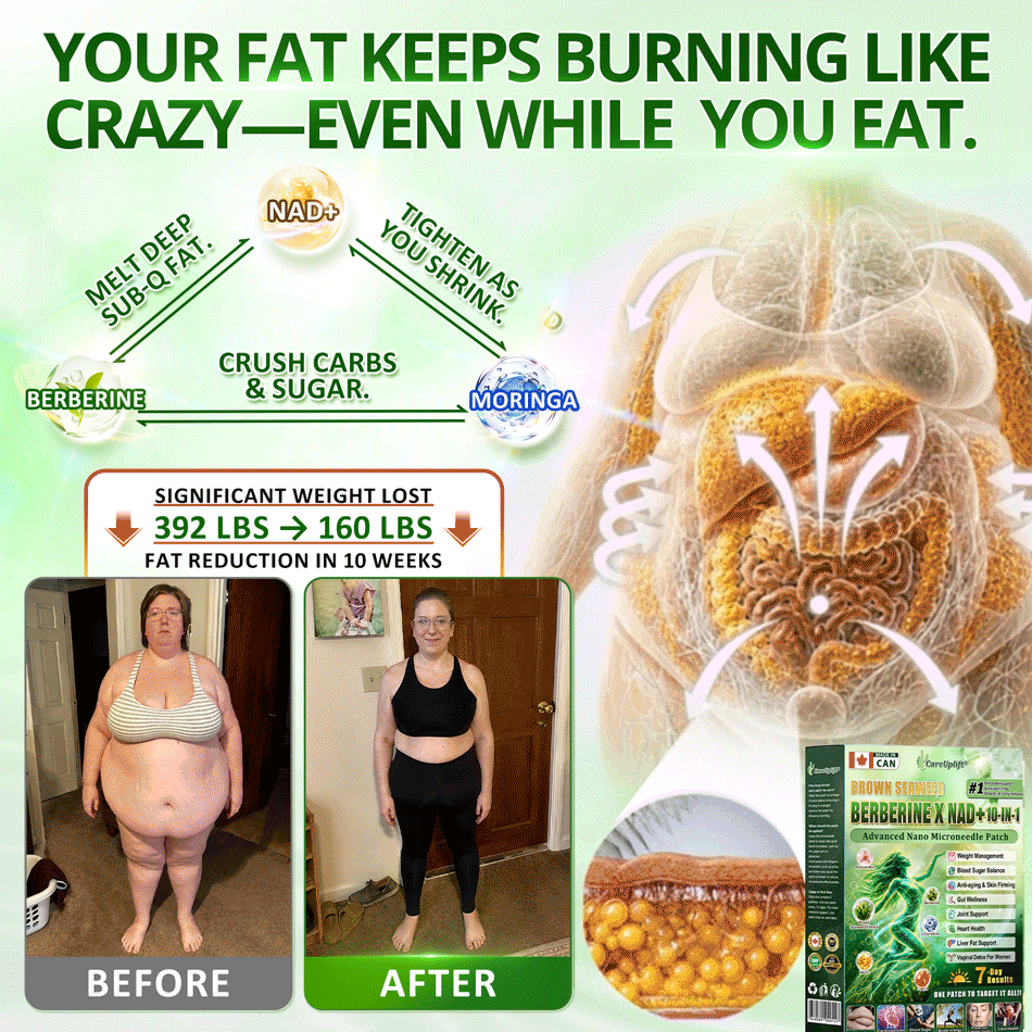 𝑶𝒇𝒇𝒊𝒄𝒊𝒂𝒍 𝑺𝒕𝒐𝒓𝒆 | 𝐍𝐞𝐰!🍀𝐂𝐚𝐫𝐞𝐔𝐩𝐥𝐢𝐟𝐭® 𝐁𝐫𝐨𝐰𝐧 𝐒𝐞𝐚𝐰𝐞𝐞𝐝× 𝐁𝐞𝐫𝐛𝐞𝐫𝐢𝐧𝐞× 𝐍𝐃𝐀+ 𝟏𝟎-𝐢𝐧-𝟏 𝐍𝐚𝐧𝐨 𝐌𝐢𝐜𝐫𝐨𝐧𝐞𝐞𝐝𝐥𝐞 𝐏𝐚𝐭𝐜𝐡(𝐉𝐮𝐬𝐭 𝐨𝐧𝐜𝐞 𝐚 𝐝𝐚𝐲, 𝐯𝐢𝐬𝐢𝐛𝐥𝐞 𝐜𝐡𝐚𝐧𝐠𝐞𝐬 𝐢𝐧 𝟕 𝐝𝐚𝐲𝐬）𝘽𝙚𝙧𝙗𝙚𝙧𝙞𝙣𝙚 + 𝐁𝐫𝐨𝐰𝐧 𝐒𝐞𝐚𝐰𝐞𝐞𝐝 𝙁𝙤𝙧𝙢𝙪𝙡𝙖 ✅ 𝐅𝐨𝐫 𝐨𝐛𝐞𝐬𝐢𝐭𝐲, 𝗟𝗼𝗼𝘀𝗲 𝘀𝗸𝗶𝗻,𝐝𝐢𝐚𝐛𝐞𝐭𝐞𝐬, 𝐬𝐥𝐞𝐞𝐩 𝐚𝐩𝐧𝐞𝐚, 𝐣𝐨𝐢𝐧𝐭 𝐢𝐬𝐬𝐮𝐞𝐬, 𝐚𝐧𝐝 𝐦𝐨𝐫𝐞💯💯