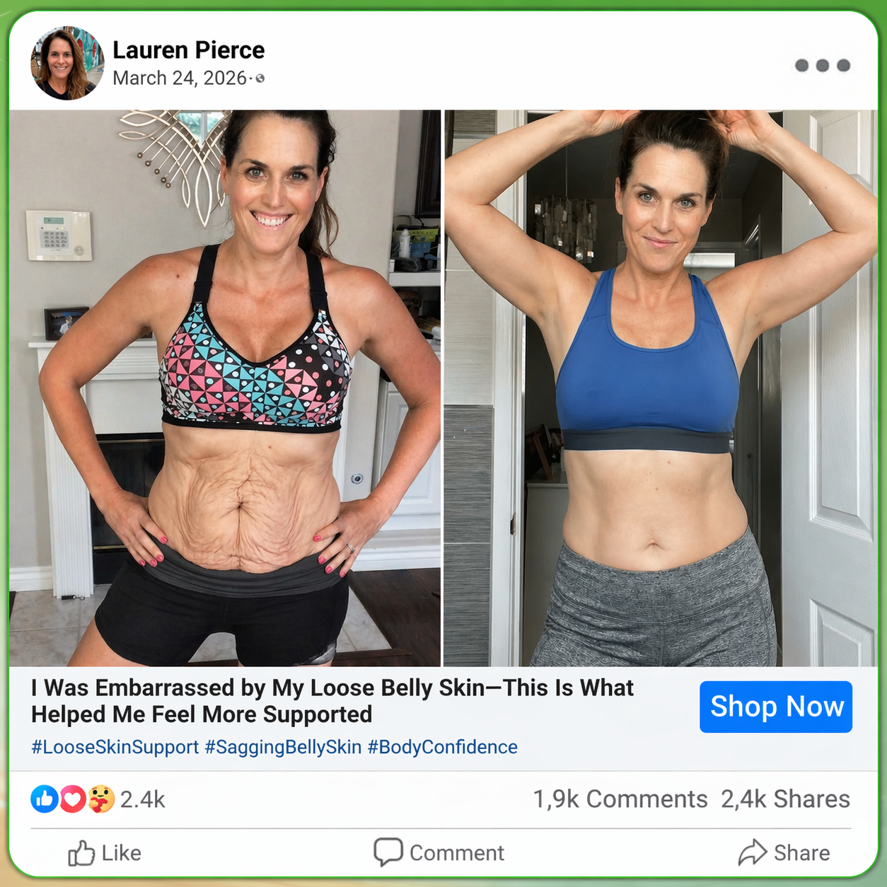 🇨🇦𝑶𝒇𝒇𝒊𝒄𝒊𝒂𝒍 𝑺𝒕𝒐𝒓𝒆  | 💖💖 𝐂𝐚𝐫𝐞𝐔𝐩𝐥𝐢𝐟𝐭® 𝙈𝒐𝒓𝒊𝒏𝒈𝗮 · 𝗕𝗲𝗿𝗯𝐞𝐫𝐢𝐧𝙚 × 𝙉𝑨𝑫+ 𝟏𝟎-𝙞𝙣-𝟏 𝘼𝒅𝒗𝒂𝒏𝒄𝒆𝐝 𝐍𝐚𝐧𝙤 𝙈𝙞𝙘𝙧𝙤𝙣𝒆𝒆𝒅𝒍𝐞 𝐏𝐚𝐭𝙘𝙝(𝐉𝐮𝐬𝐭 𝐨𝐧𝐜𝐞 𝐚 𝐝𝐚𝐲, 𝐯𝐢𝐬𝐢𝐛𝐥𝐞 𝐜𝐡𝐚𝐧𝐠𝐞𝐬 𝐢𝐧 𝟕 𝐝𝐚𝐲𝐬） ✅ 𝐅𝐨𝐫 𝐨𝐛𝐞𝐬𝐢𝐭𝐲, 🅛🅞🅞🅢🅔 🅢🅚🅘🅝,𝐝𝐢𝐚𝐛𝐞𝐭𝐞𝐬, 𝐬𝐥𝐞𝐞𝐩 𝐚𝐩𝐧𝐞𝐚, 𝐣𝐨𝐢𝐧𝐭 𝐢𝐬𝐬𝐮𝐞𝐬, 𝐚𝐧𝐝 𝐦𝐨𝐫𝐞